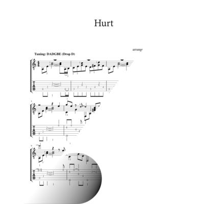 Hurt