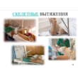 NURSING OF PATIENTS WITH SKELET EXTENSION
